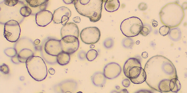 PROSTATE LIQUID ANALISYS - MYPHAGES