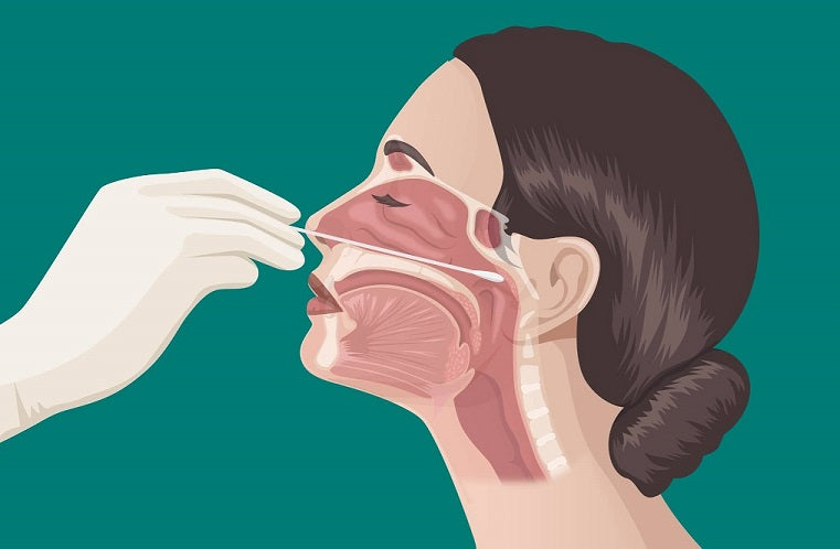 SMEAR NOSE ANALISYS - MYPHAGES